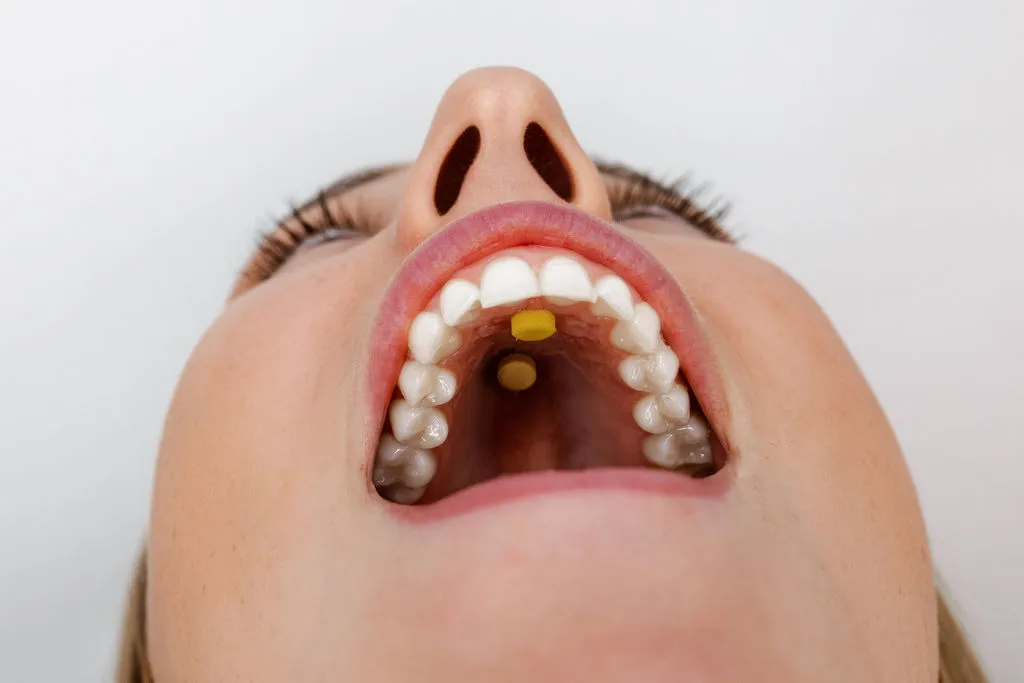 Logicana-Myospots-tongue elevation Logicana-Myospots-tongue exercise-optimal breathing-tongue elevation-tongue posture-nasal breathing