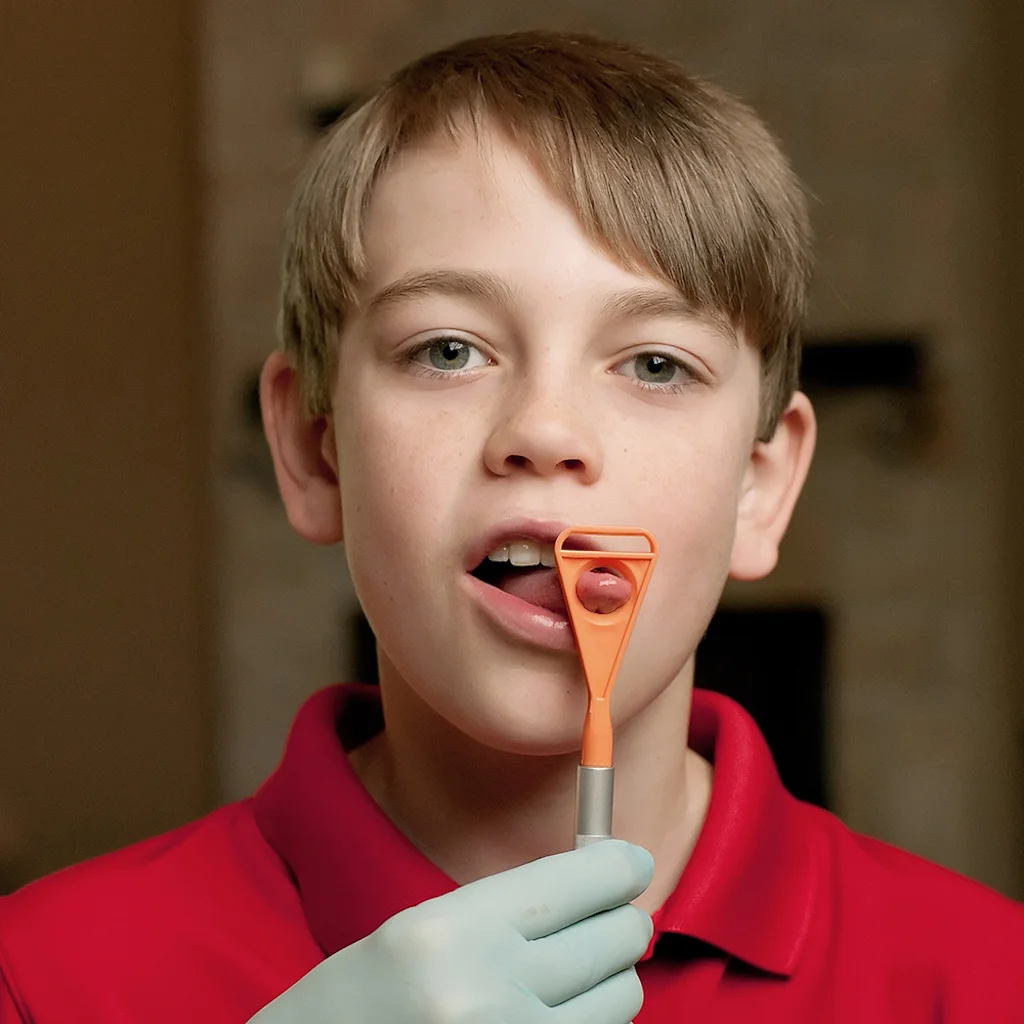 ARK Zungen Aufsatz – Zungenspitzer-Funktion zur gezielten Schulung der Zungenspitze