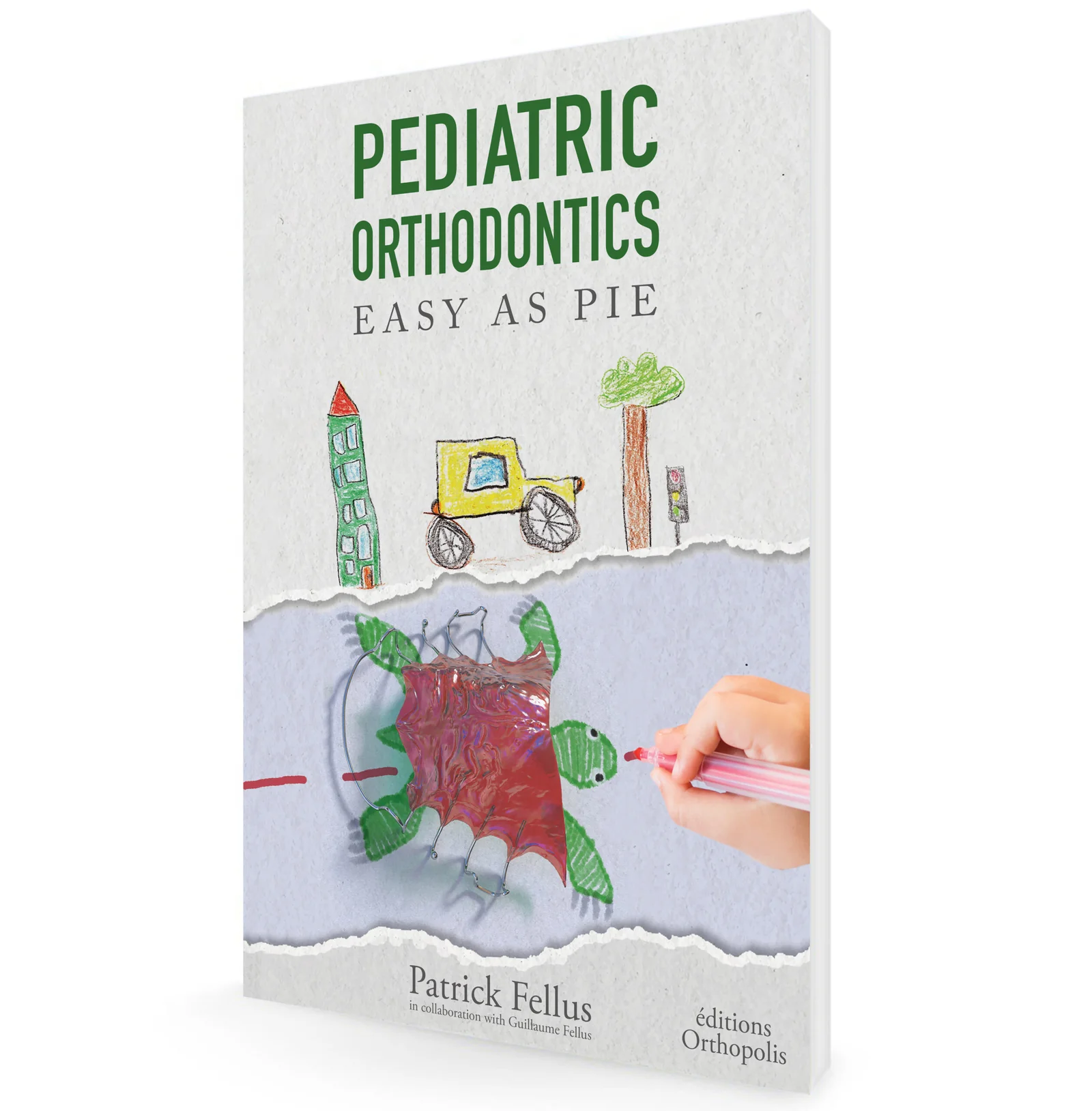 Pediatric orthodontics-Jaw misalignments-Child-friendly orthodontics