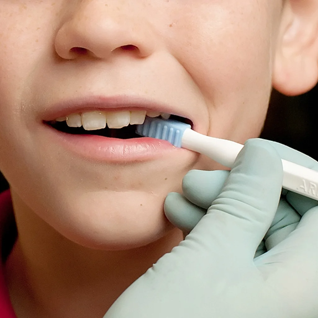 ARK Probe used to stimulate lips tongue cheeks palate and gums by tapping stroking and applying gentle pressure